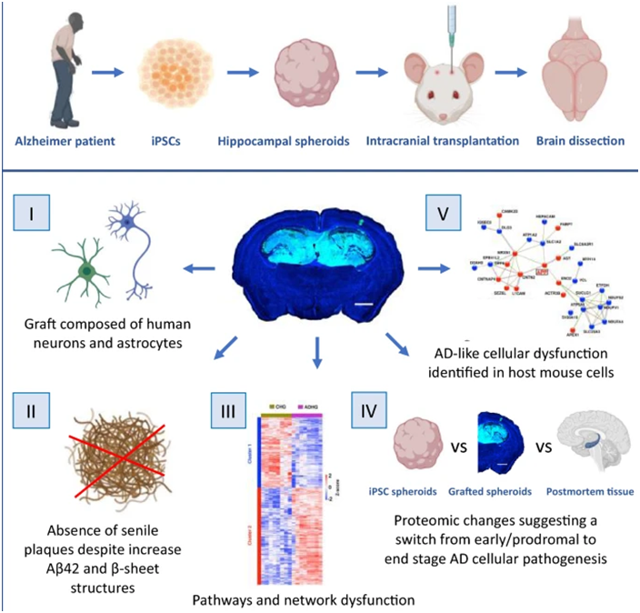 Acta Neuropathol Com：利用源自阿爾茨海默病患者的誘導性多能干細胞構建新的疾病模型，有助更好理解這種疾病如何在大腦中進展