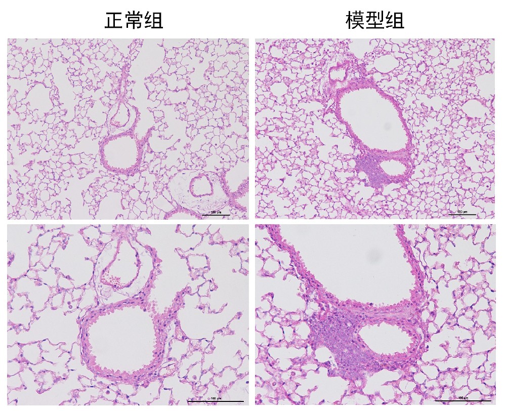 小鼠哮喘模型